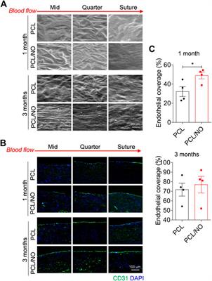 Nitrate-Functionalized poly(ε-Caprolactone) Small-Diameter Vascular Grafts Enhance Vascular Regeneration via Sustained Release of Nitric Oxide